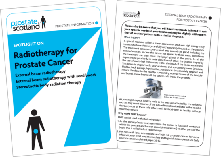 Spotlight On Radiotherapy For Prostate Cancer Prostate Scotland 